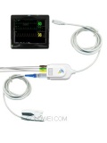 Model PM60C ECG&SPO2 Monitor  