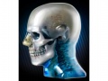 Diagnostic Head Phantom Model 711HN